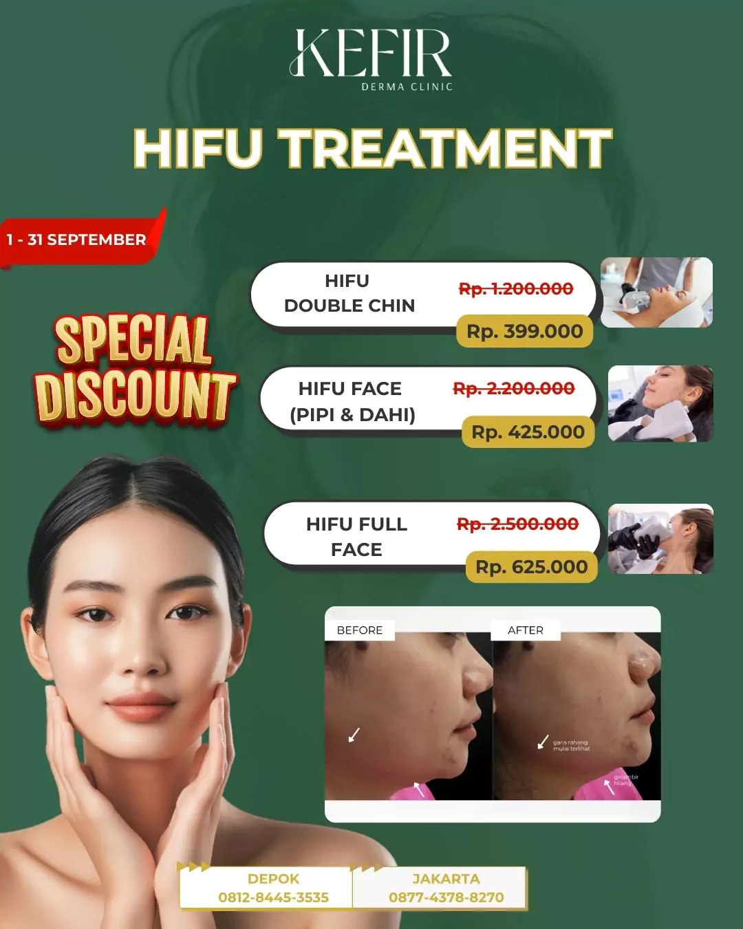 hifu-treatment-sept-2025-webp